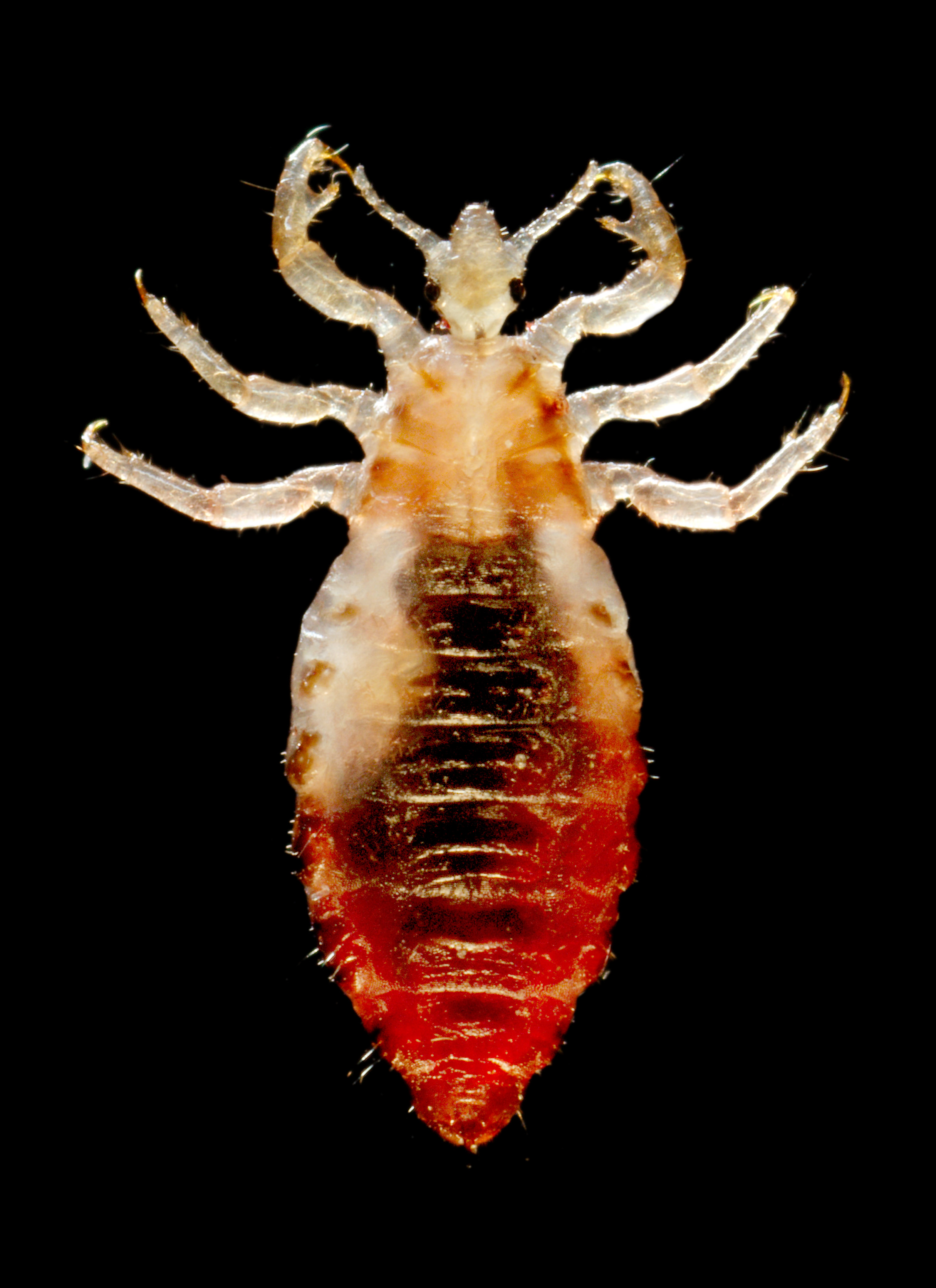 Close up of a louse, positioned as if for scientific examination on a slide